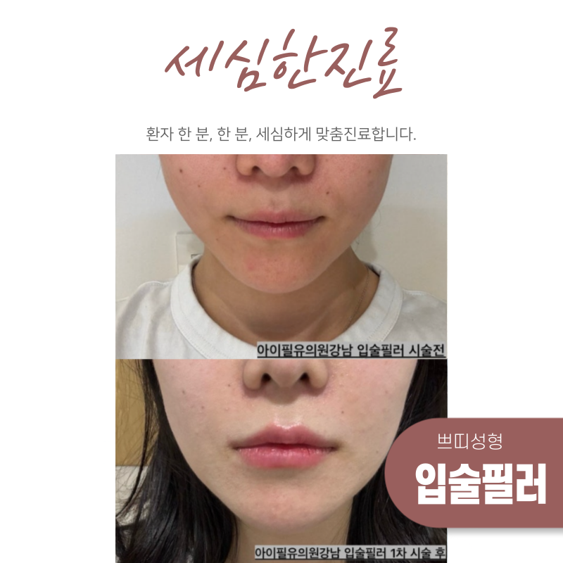 세심한 입술 디자인과 시술