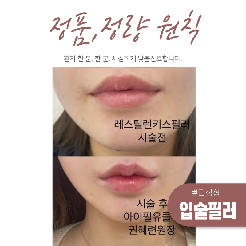 정품,정량 원칙 시술