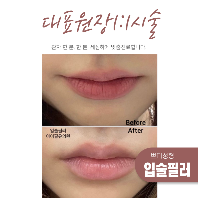 대표원장1:1시술